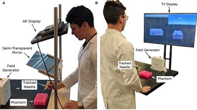 Augmented Reality Guided Needle Biopsy of Soft Tissue: A Pilot Study